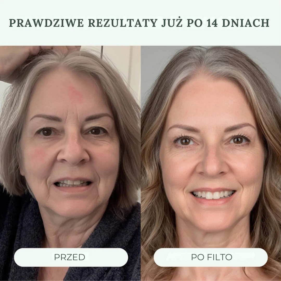 Słuchawka prysznicowa Filto™