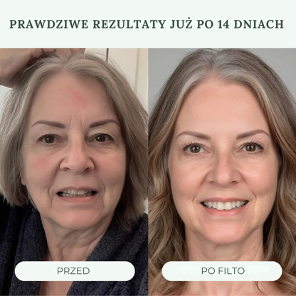 Słuchawka prysznicowa Filto™